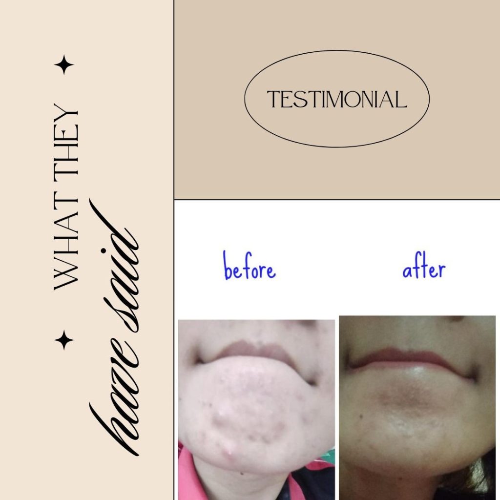 Beauty and Health Skin