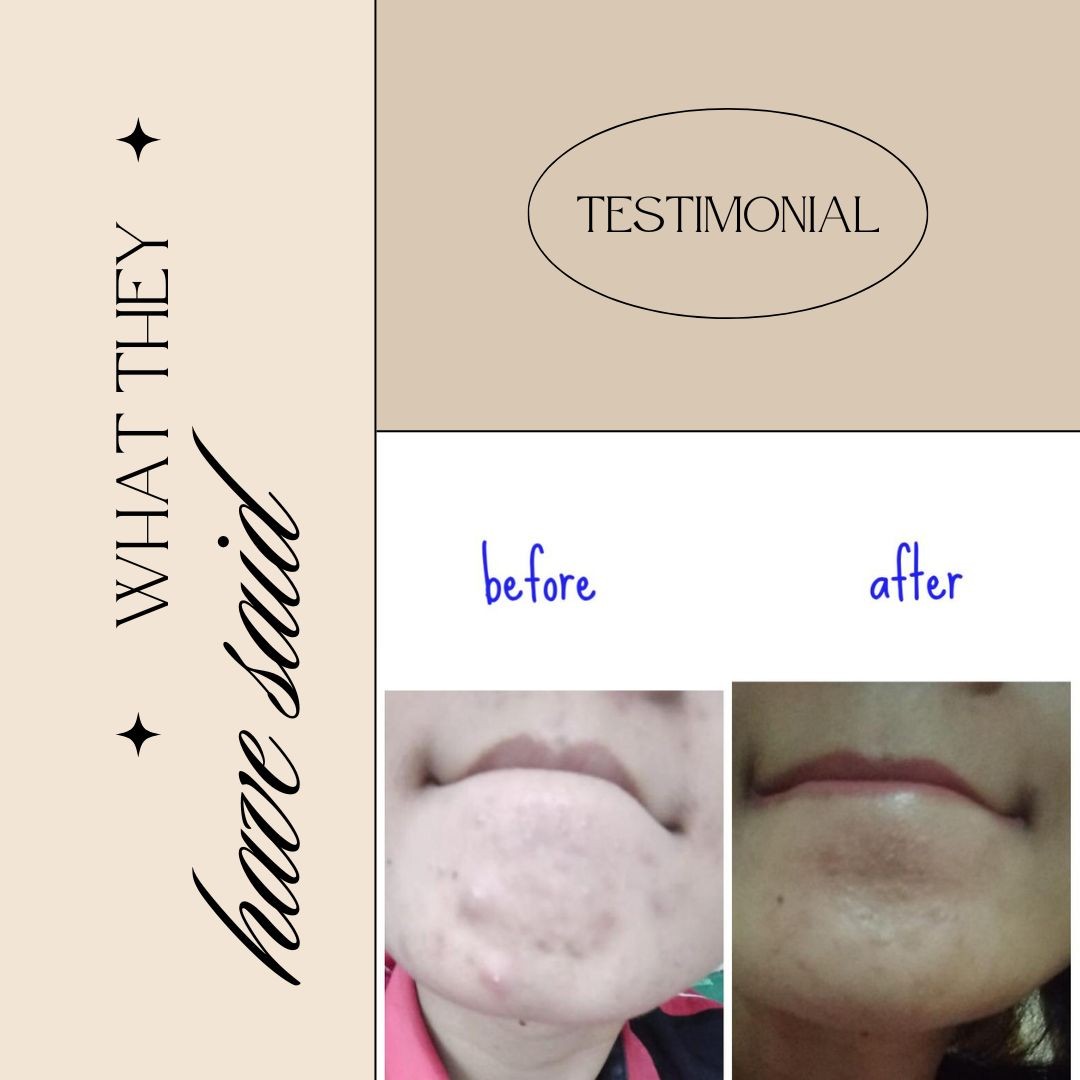 Beauty and Health Skin