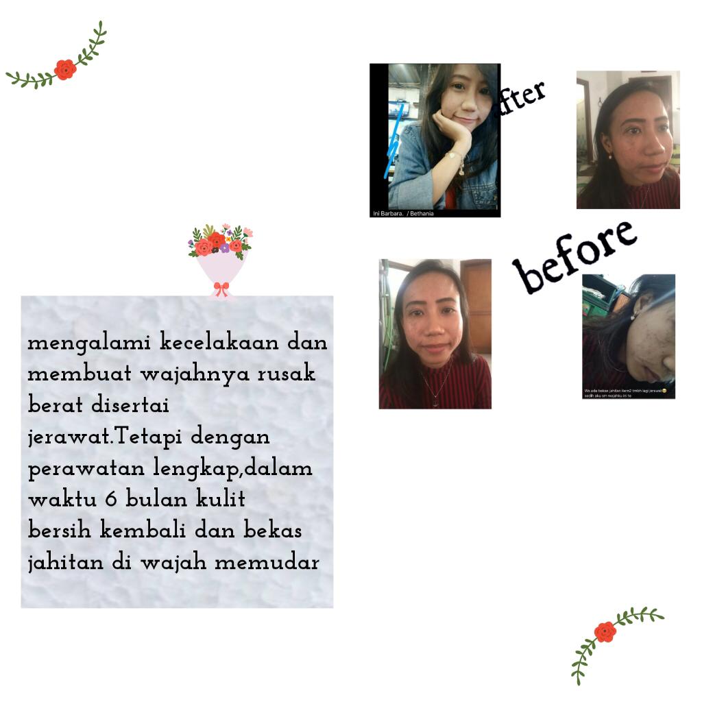 Recovery after an accident